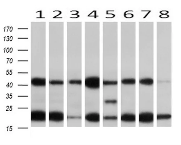 Western blot - Anti-MEK1 antibody [OTI4E1] (AB139343)