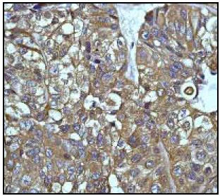 Immunohistochemistry (Formalin/PFA-fixed paraffin-embedded sections) - Anti-MEK1 antibody [Y77] (AB32576)