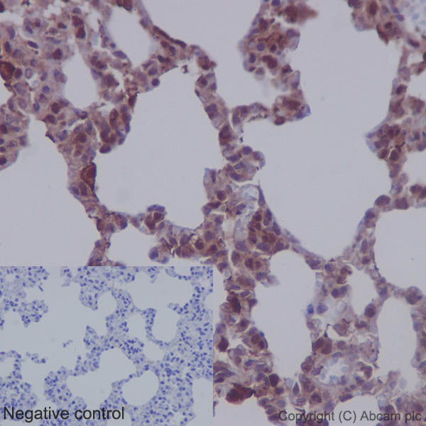 Immunohistochemistry (Formalin/PFA-fixed paraffin-embedded sections) - Anti-MEK1 + MEK2 antibody [EPR16667] (AB178876)
