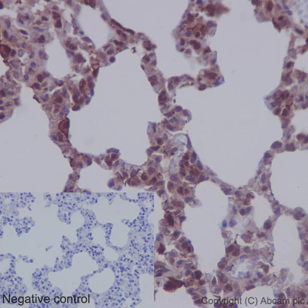 Immunohistochemistry (Formalin/PFA-fixed paraffin-embedded sections) - Anti-MEK1 + MEK2 antibody [EPR16667] (AB178876)