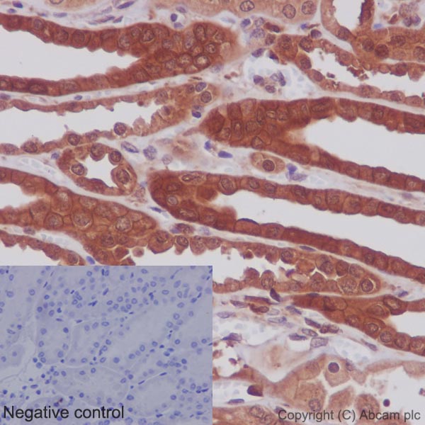 Immunohistochemistry (Formalin/PFA-fixed paraffin-embedded sections) - Anti-MEK1 + MEK2 antibody [EPR16667] - BSA and Azide free (AB215263)