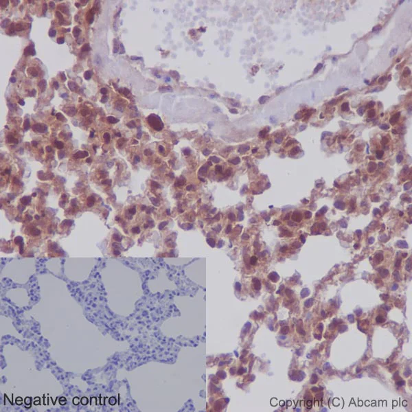 Immunohistochemistry (Formalin/PFA-fixed paraffin-embedded sections) - Anti-MEK1 + MEK2 antibody [EPR16667] - BSA and Azide free (AB215263)