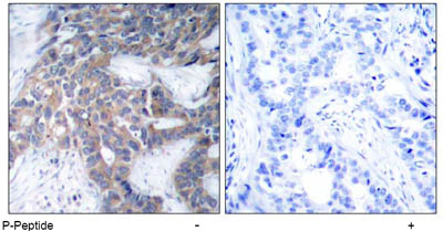 Immunohistochemistry (Formalin/PFA-fixed paraffin-embedded sections) - Anti-MEK1 (phospho S218) + MEK2 (phospho 222) antibody (AB47295)
