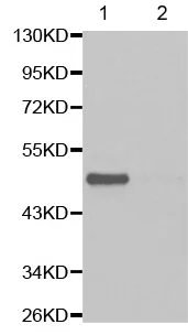 Western blot - Anti-MEK1 (phospho S218) + MEK2 (phospho S222) antibody (AB194754)