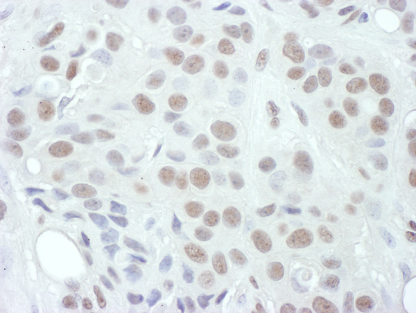 Immunohistochemistry (Formalin/PFA-fixed paraffin-embedded sections) - Anti-MEK1 (phospho T286) antibody (AB129431)