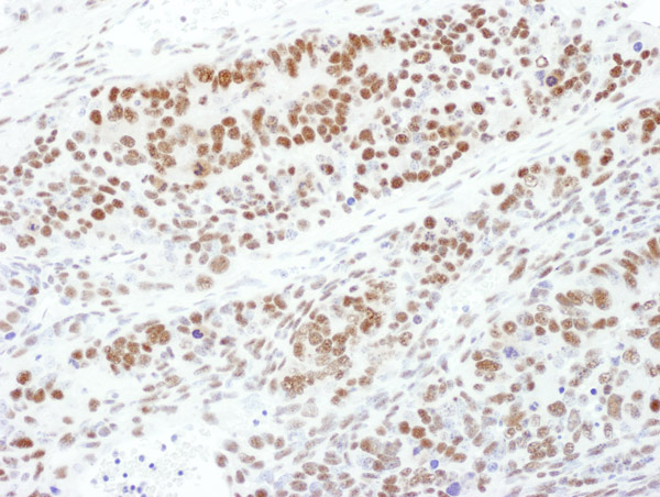 Immunohistochemistry (Formalin/PFA-fixed paraffin-embedded sections) - Anti-MEK1 (phospho T286) antibody (AB129457), expandable thumbnail