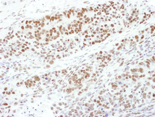 Immunohistochemistry (Formalin/PFA-fixed paraffin-embedded sections) - Anti-MEK1 (phospho T286) antibody (AB129457)