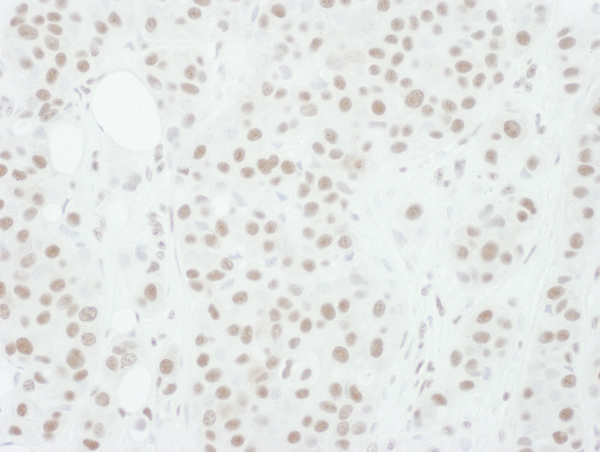 Immunohistochemistry (Formalin/PFA-fixed paraffin-embedded sections) - Anti-MEK1 (phospho T286) antibody (AB129457), expandable thumbnail