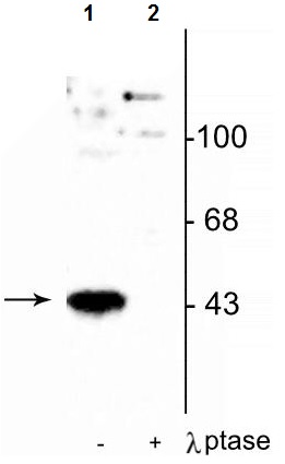 Western blot - Anti-MEK1 (phospho T386) antibody (AB254096), expandable thumbnail