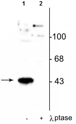 Western blot - Anti-MEK1 (phospho T386) antibody (AB254096)