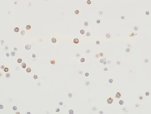 Immunocytochemistry - Anti-MEK2 antibody [BLR079G] (AB265586)