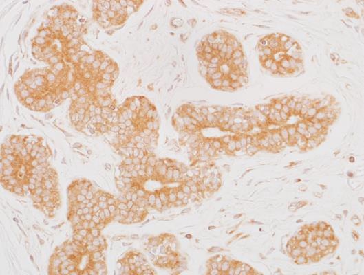 Immunohistochemistry (Formalin/PFA-fixed paraffin-embedded sections) - Anti-MEK2 antibody [BLR079G] (AB265586)