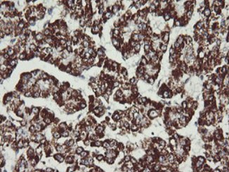 Immunohistochemistry (Formalin/PFA-fixed paraffin-embedded sections) - Anti-MEK2 antibody [OTI1A2] (AB140372)
