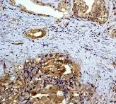 Immunohistochemistry (Formalin/PFA-fixed paraffin-embedded sections) - Anti-MEK2 antibody [Y78] (AB32517)