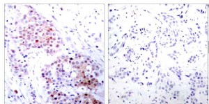 Immunohistochemistry (Formalin/PFA-fixed paraffin-embedded sections) - Anti-MEK2 (phospho T394) antibody (AB30622)