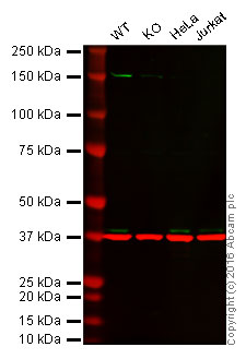 Western blot - Anti-MEK3 antibody [EP555Y] (AB40836)