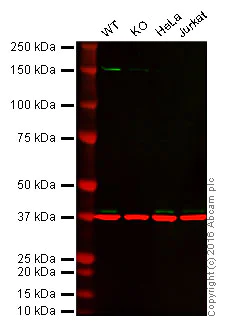 Western blot - Anti-MEK3 antibody [EP555Y] - BSA and Azide free (AB247295)