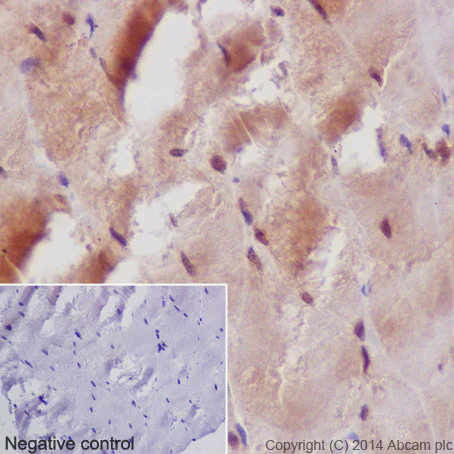 Immunohistochemistry (Formalin/PFA-fixed paraffin-embedded sections) - Anti-MEK3 antibody [EPR17345-104] (AB195037)