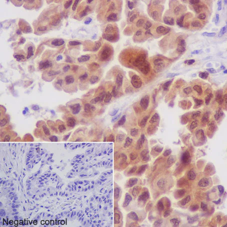 Immunohistochemistry (Formalin/PFA-fixed paraffin-embedded sections) - Anti-MEK3 antibody [EPR17345-104] (AB195037)