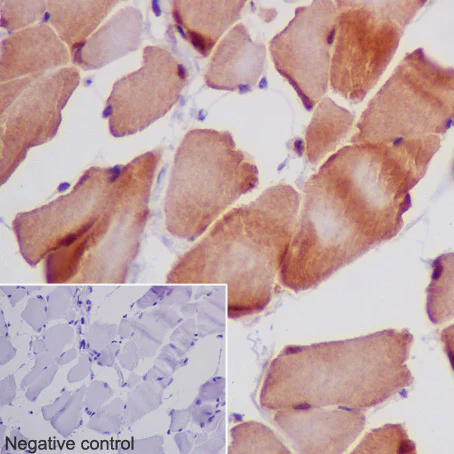 Immunohistochemistry (Formalin/PFA-fixed paraffin-embedded sections) - Anti-MEK3 antibody [EPR17345-104] (AB195037)