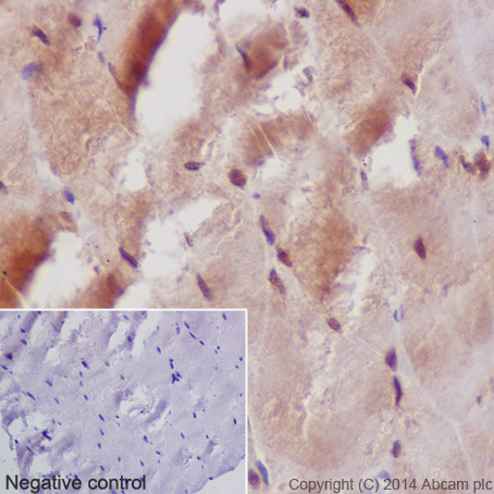 Immunohistochemistry (Formalin/PFA-fixed paraffin-embedded sections) - Anti-MEK3 antibody [EPR17345-104] - BSA and Azide free (AB231166)