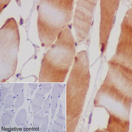 Immunohistochemistry (Formalin/PFA-fixed paraffin-embedded sections) - Anti-MEK3 antibody [EPR17345-104] - BSA and Azide free (AB231166)