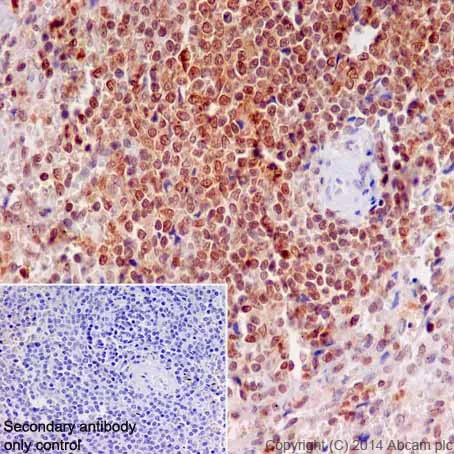 Immunohistochemistry (Formalin/PFA-fixed paraffin-embedded sections) - Anti-MEK3 + MEK6 antibody [EPR17340] (AB200831)