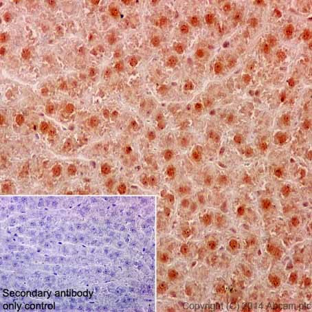 Immunohistochemistry (Formalin/PFA-fixed paraffin-embedded sections) - Anti-MEK3 + MEK6 antibody [EPR17340] - BSA and Azide free (AB251322), expandable thumbnail