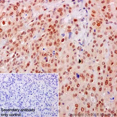 Immunohistochemistry (Formalin/PFA-fixed paraffin-embedded sections) - Anti-MEK3 + MEK6 antibody [EPR17340] - BSA and Azide free (AB251322), expandable thumbnail