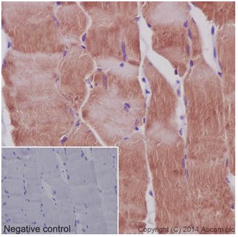 Immunohistochemistry (Formalin/PFA-fixed paraffin-embedded sections) - Anti-MEK3 + MEK6 antibody [EPR17345] (ab181555), expandable thumbnail