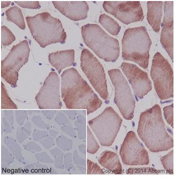 Immunohistochemistry (Formalin/PFA-fixed paraffin-embedded sections) - Anti-MEK3 + MEK6 antibody [EPR17345] (ab181555), expandable thumbnail