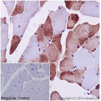 Immunohistochemistry (Formalin/PFA-fixed paraffin-embedded sections) - Anti-MEK3 + MEK6 antibody [EPR17345] (ab181555), expandable thumbnail