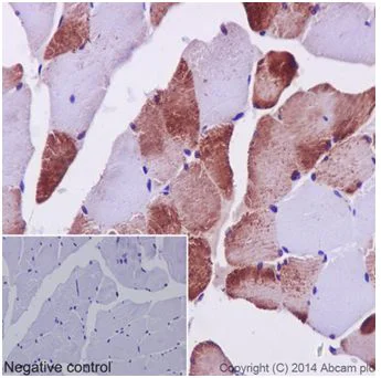 Immunohistochemistry (Formalin/PFA-fixed paraffin-embedded sections) - Anti-MEK3 + MEK6 antibody [EPR17345] (AB181555)