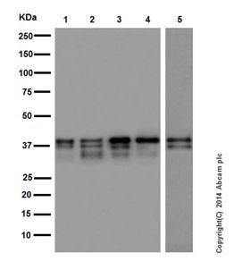 Western blot - Anti-MEK3 + MEK6 antibody [EPR17345] (AB181555), expandable thumbnail