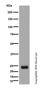 Western blot - Anti-MEK3 + MEK6 antibody [EPR17345] (AB181555)