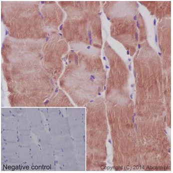 Immunohistochemistry (Formalin/PFA-fixed paraffin-embedded sections) - Anti-MEK3 + MEK6 antibody [EPR17345] - BSA and Azide free (AB250507)
