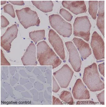 Immunohistochemistry (Formalin/PFA-fixed paraffin-embedded sections) - Anti-MEK3 + MEK6 antibody [EPR17345] - BSA and Azide free (AB250507)