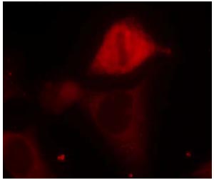 Immunocytochemistry/ Immunofluorescence - Anti-MEK3 (phospho S189) antibody (AB131283)