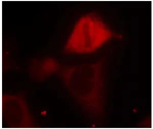 Immunocytochemistry/ Immunofluorescence - Anti-MEK3 (phospho S189) antibody (AB131283)