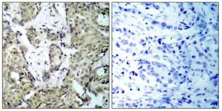Immunohistochemistry (Formalin/PFA-fixed paraffin-embedded sections) - Anti-MEK3 (phospho S189) antibody (AB131283)