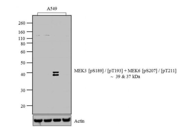 Western blot - Anti-MEK3 (phospho S189/T193) + MEK6 (phospho S207/T211) antibody (AB4759), expandable thumbnail