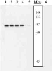 Western blot - Anti-MEK3 (phospho S189/T193) + MEK6 (phospho S207/T211) antibody (AB4759), expandable thumbnail