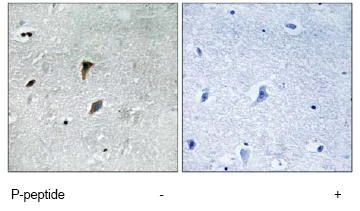 Immunohistochemistry (Formalin/PFA-fixed paraffin-embedded sections) - Anti-MEK3 (phospho T222) antibody (AB79586)