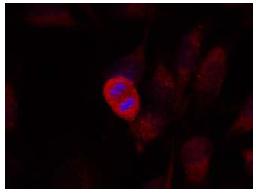 Immunocytochemistry/ Immunofluorescence - Anti-MEK4/MKK4 antibody (AB131494)