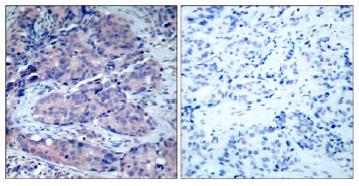 Immunohistochemistry (Formalin/PFA-fixed paraffin-embedded sections) - Anti-MEK4/MKK4 antibody (AB131494)