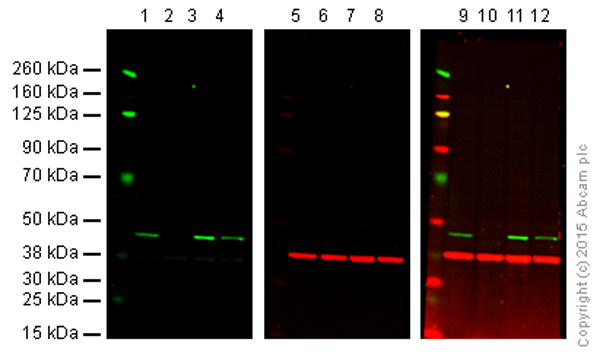 Western blot - Anti-MEK4/MKK4 antibody [EP615Y] (AB33912)