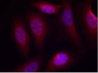 Immunocytochemistry/ Immunofluorescence - Anti-MEK4/MKK4 (phospho S80) antibody (AB131353)