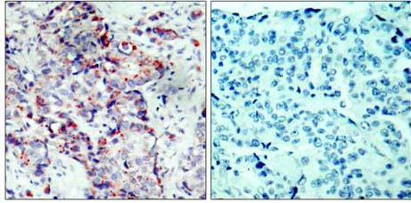 Immunohistochemistry (Formalin/PFA-fixed paraffin-embedded sections) - Anti-MEK4/MKK4 (phospho S80) antibody (AB131353)