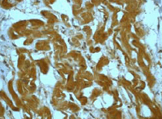 Immunohistochemistry (Formalin/PFA-fixed paraffin-embedded sections) - Anti-MEK4/MKK4 (phospho S80) antibody [EP1075Y] (AB52958), expandable thumbnail