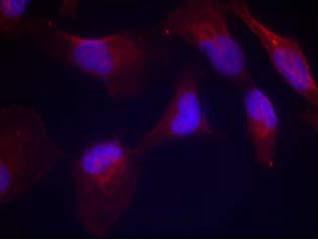 Immunocytochemistry/ Immunofluorescence - Anti-MEK4/MKK4 (phospho T261) antibody (AB131351), expandable thumbnail